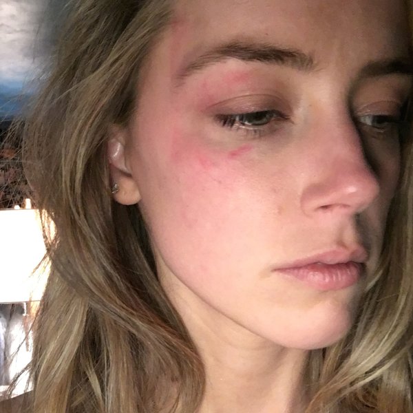 Johnny Depp e Amber Heard, è divorzio lampo. Peccato (per lui)